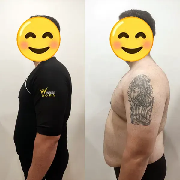 حذف چربی‌های شکم و پهلو