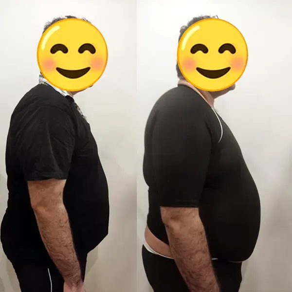 روند موفق لاغری در کلینیک