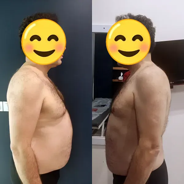 تغییرات اندام پس از درمان