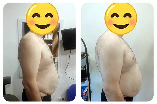 کاهش وزن موفق در کلینیک لاغری وینربادی