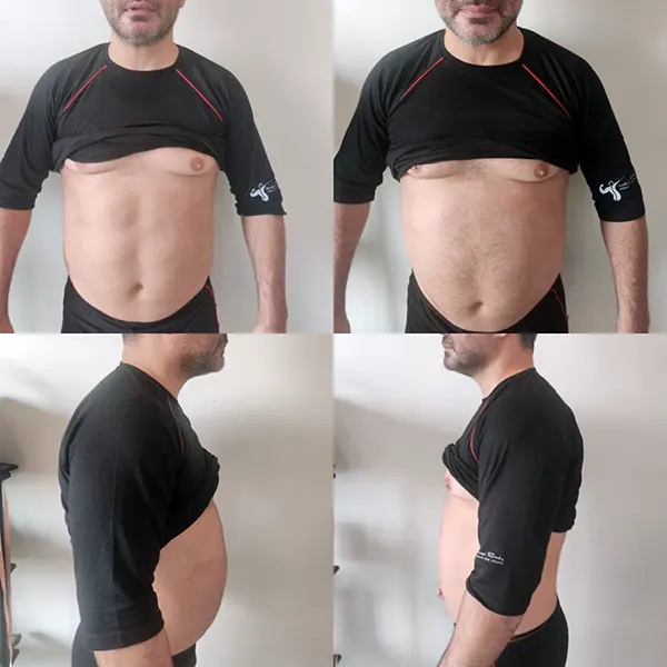 نتیجه لاغری اصولی در کلینیک