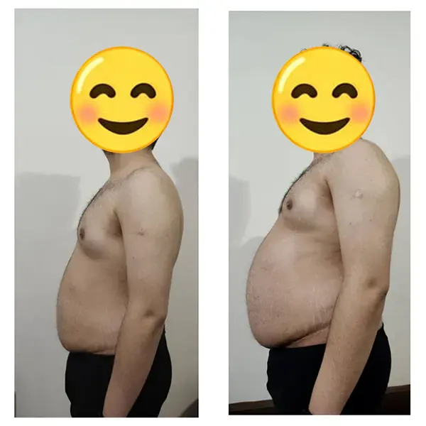 تغییرات فرم بدن پس از درمان